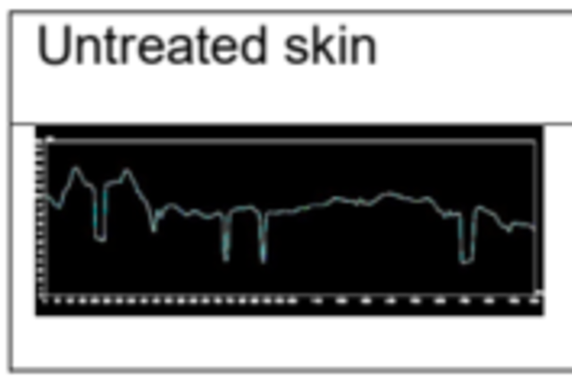 Symrise, 잔존성 평가로 비듬 방지 성분 ‘지속력’의 중요성 재조명