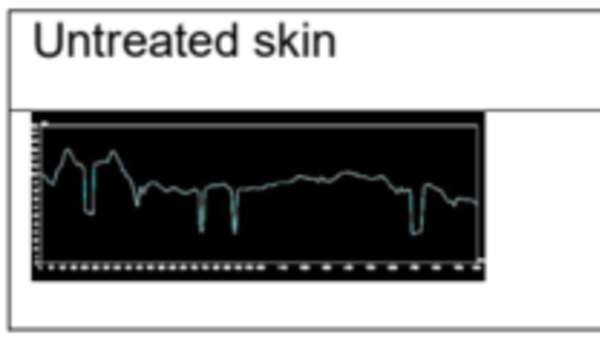 Symrise, 잔존성 평가로 비듬 방지 성분 ‘지속력’의 중요성 재조명